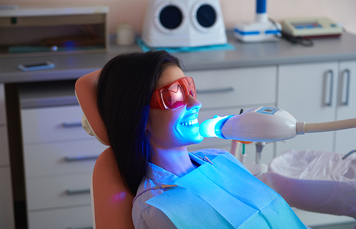 ラミネートベニア